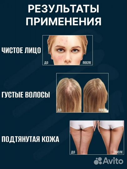 Аппарат дарсонваль