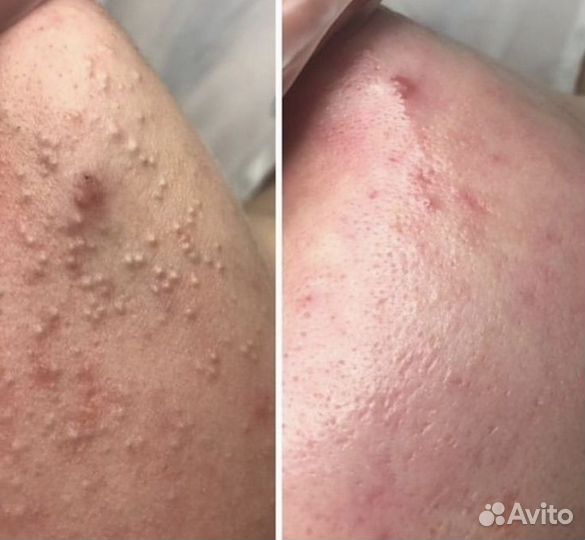 Косметолог - Эстет