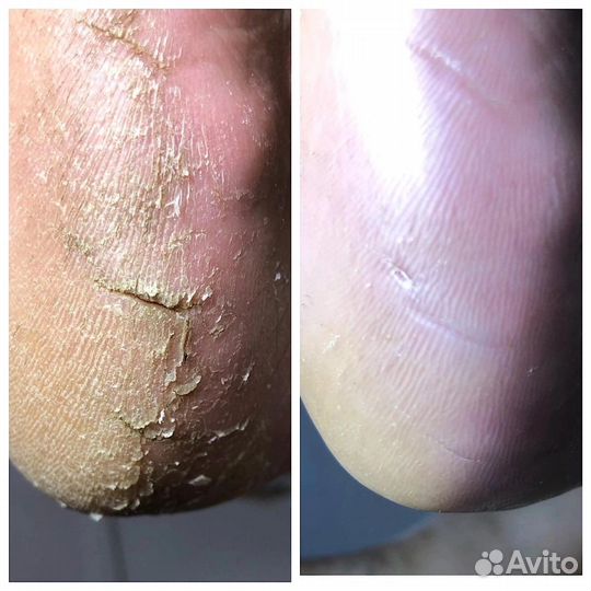 Маникюр педикюр