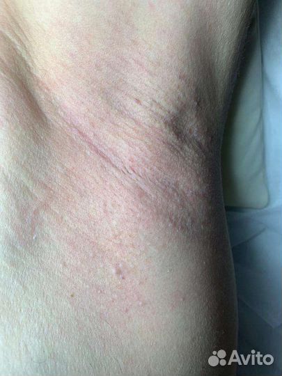 Мастер Шугаринга / Депиляции.Калининский район