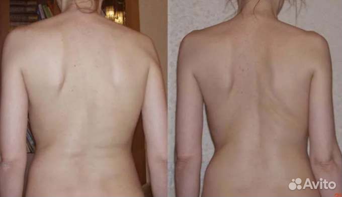 Мануальный массаж(Костоправ)