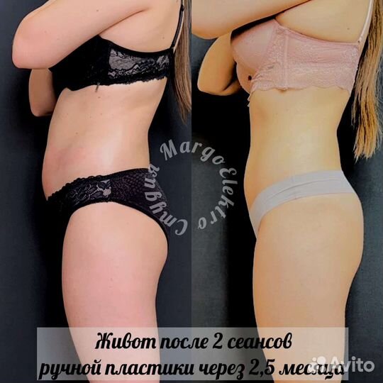 Ручная пластика тела, коррекция фигуры