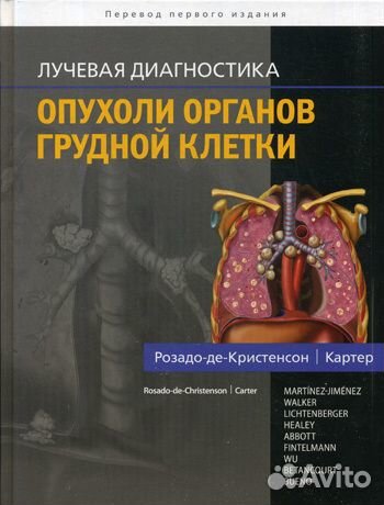 Лучевая диагностика,рентгенология,кт,мрт
