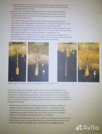 Энциклопедия эпиляции, книга по электроэпиляции