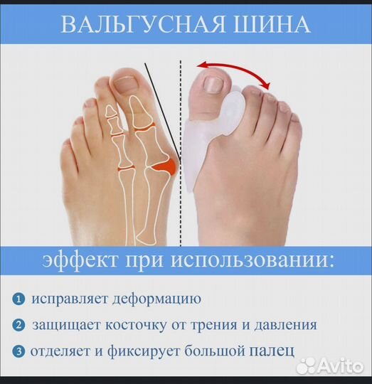 Вальгусная шина