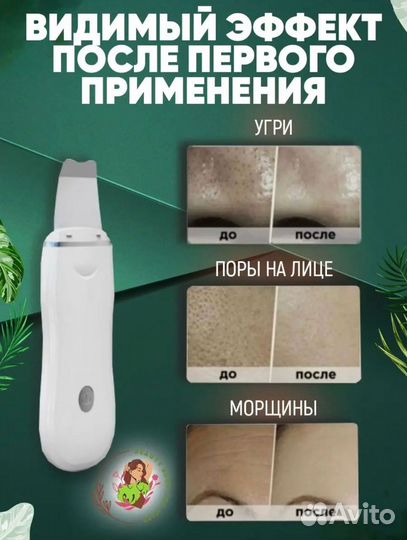 Массажер для лица
