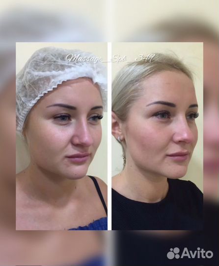 Массаж Лица/Тела.Липолитики.Обертывание