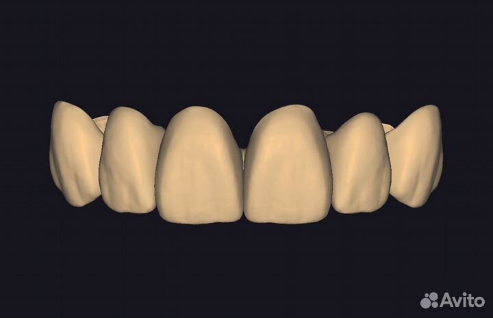 Моделировка в Exocad/Оператор cadcam