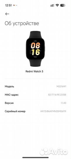 Смарт часы Xiaomi Redmi watch 3
