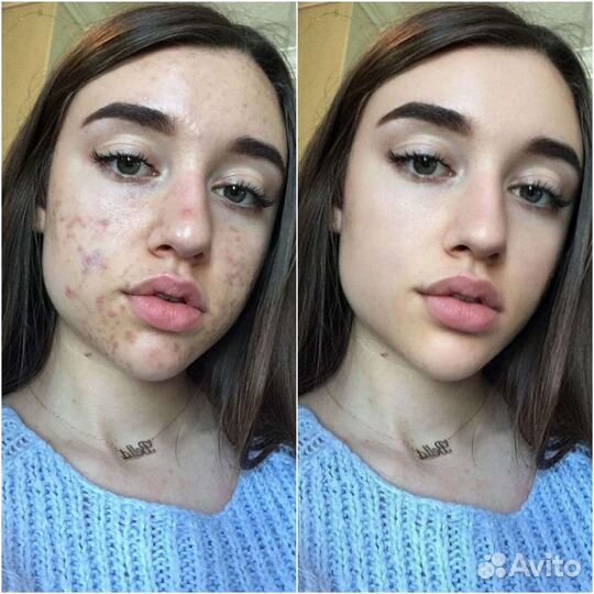 Ретушь и обработка фотографий фотошоп