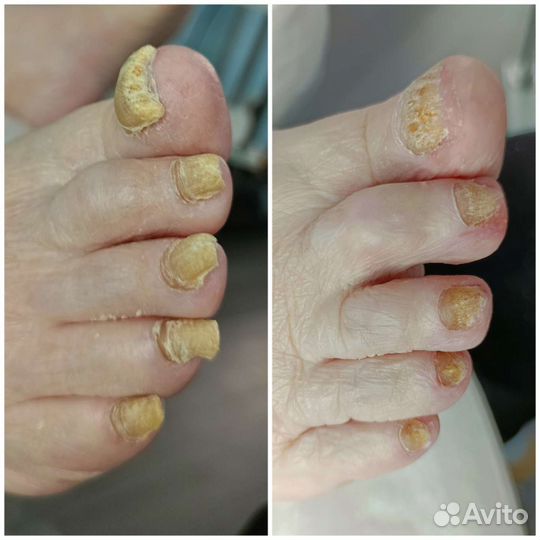 Подолог Педикюр мужской и женский