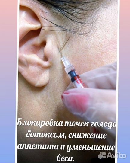 Липолитики мезотерапия