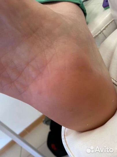 Smart педикюр,покрытие, дизайны