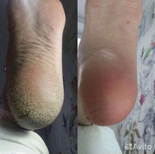 Мастер маникюра и педикюра