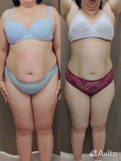 Модель на аппаратные методики коррекции фигуры