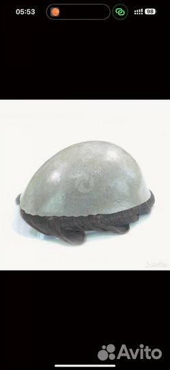 Новая система замещения волос