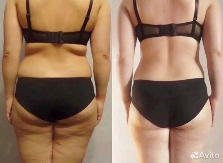 Аппаратный массаж тела