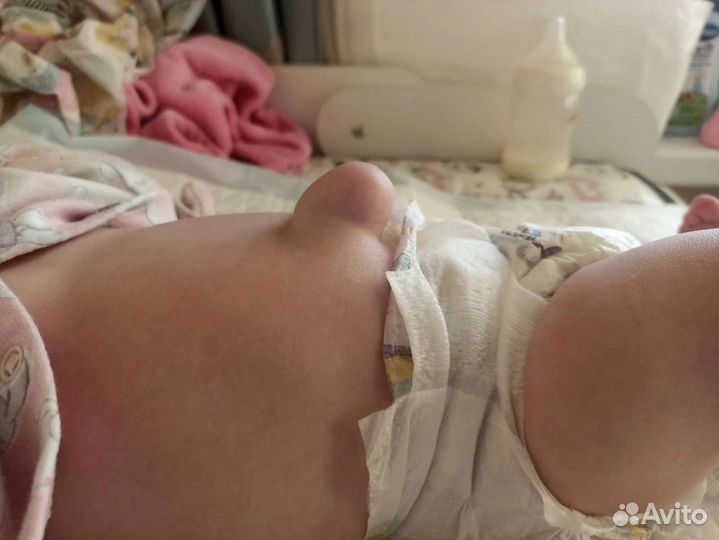 Бандаж от пупочной грыжи для новорождённых