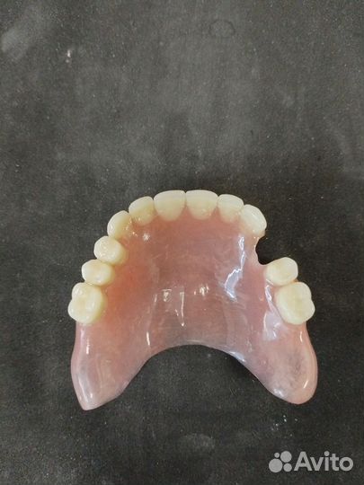 Съёмный зубной протез