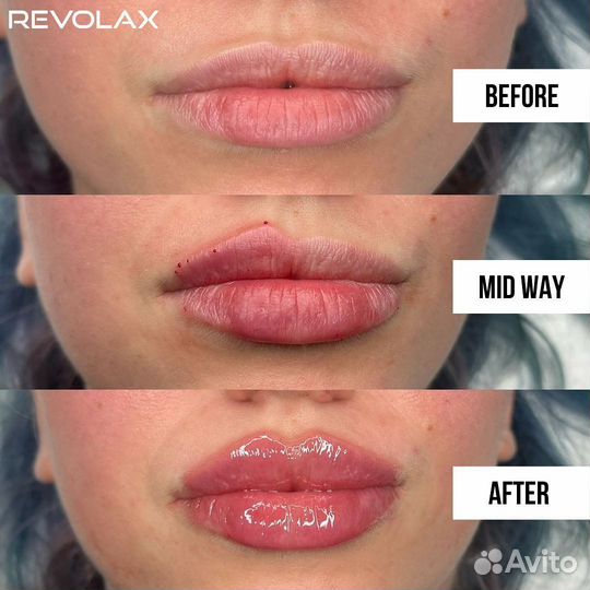 Обучение косметологов