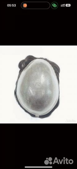 Новая система замещения волос