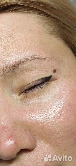 Комплекс 2-х зон перманентного макияжа