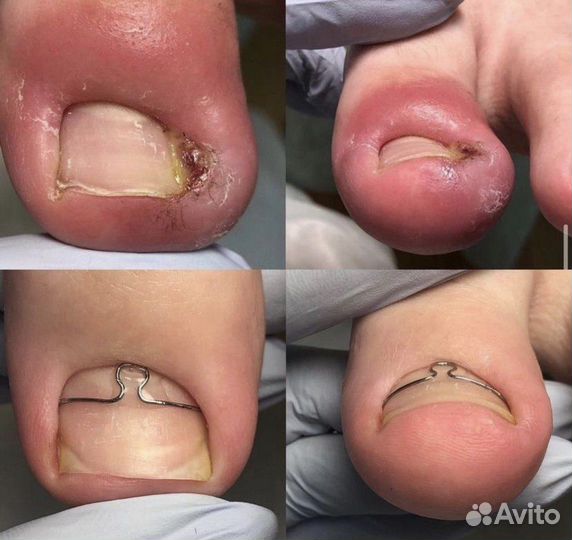 Подолог. Здоровье стоп и ногтей