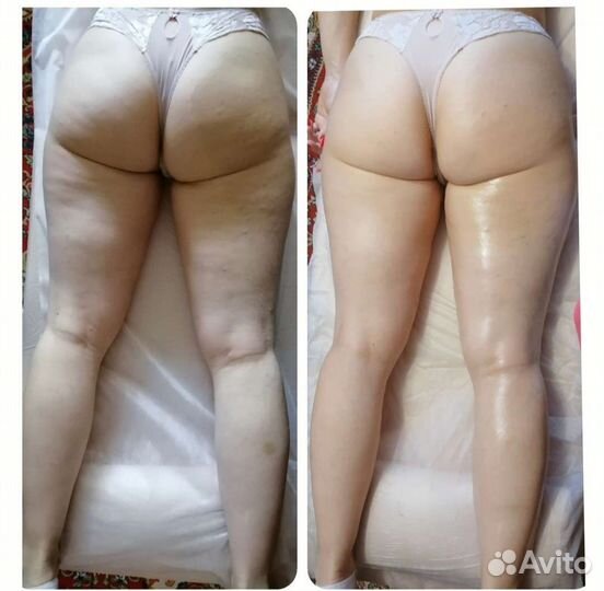 Массаж профессиональный