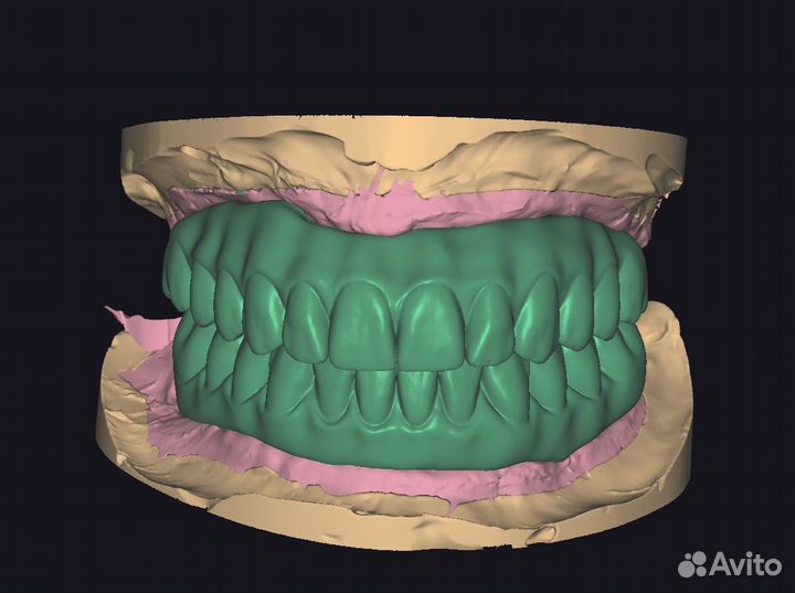 Моделировка в Exocad/Оператор cadcam