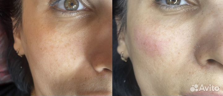 Косметолог избербаш