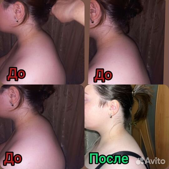Медицинский массаж