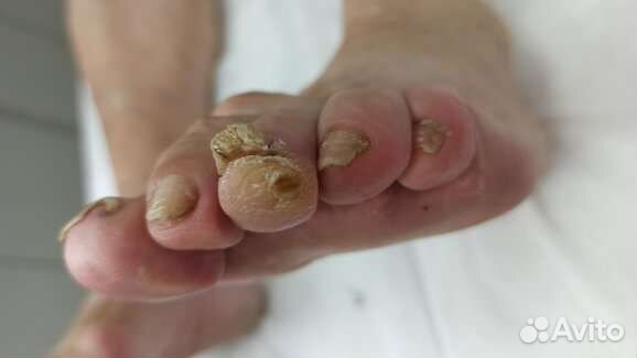 Услуги подолога