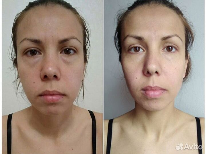 Коррекция фигуры и лица