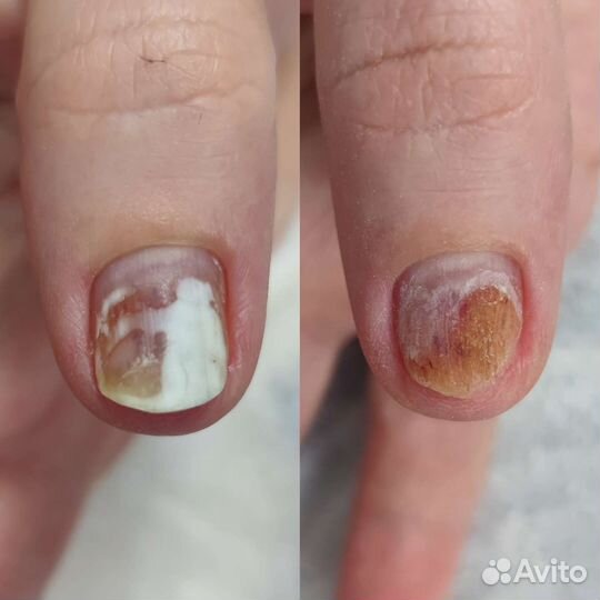 Подолог маникюр педикюр