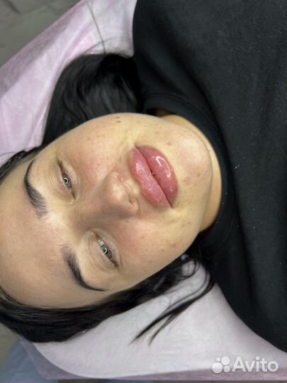 Модель на увеличение губ