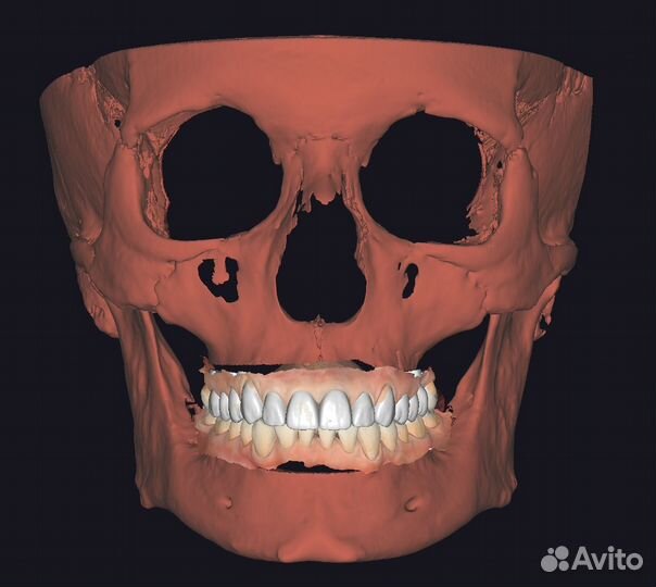 Моделировка в Exocad/Оператор cadcam