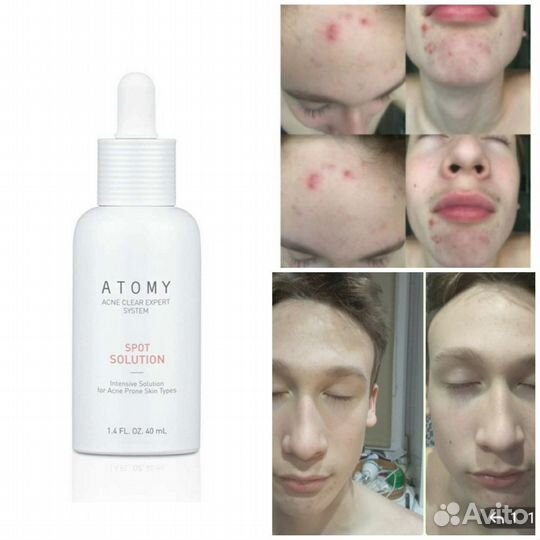 Средства для чувствительной кожи. Атоми