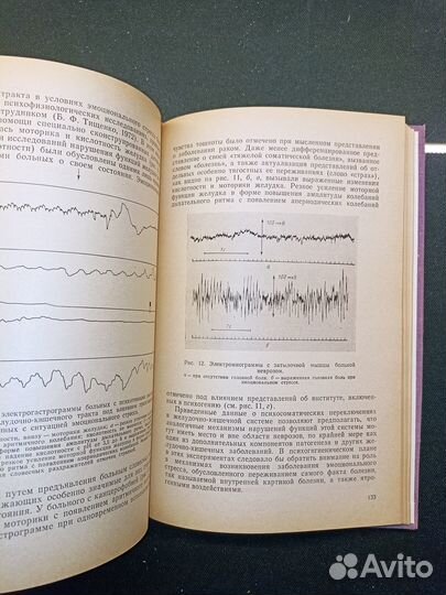 Эмоциональный стресс. Губачев. 1976