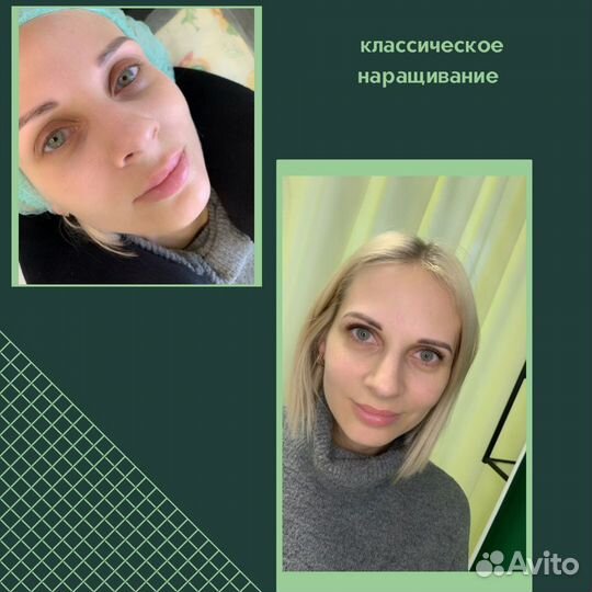 Наращивание ресниц