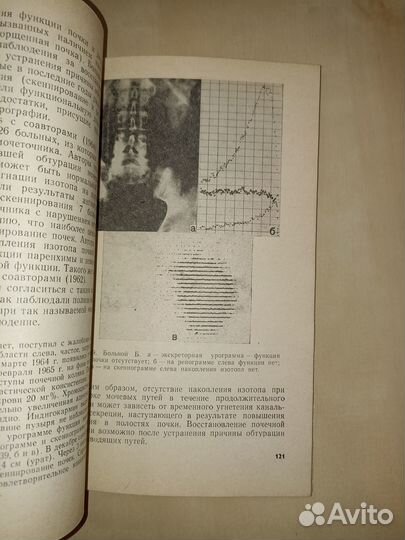 Радиоизотопная диагностика заболеваний мочевой сис