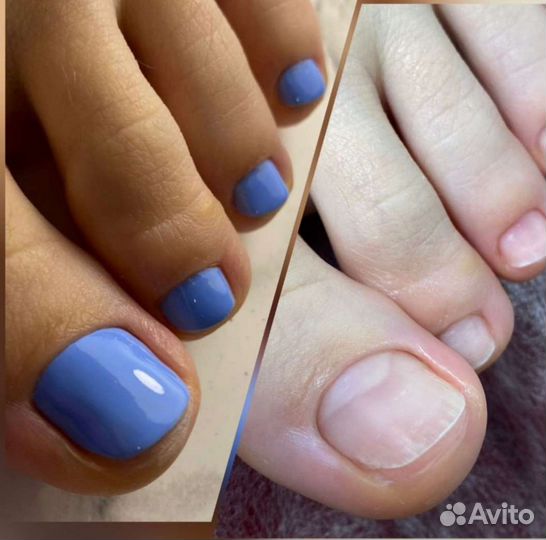 Педикюр/подология