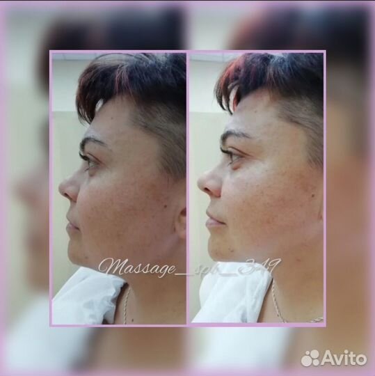 Массаж Лица/Тела.Липолитики.Обертывание