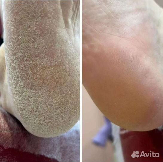 Подолог есть выезд, грибки вросшие ногти и др