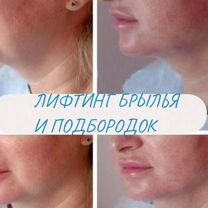 Увеличение губ плоский бант, Красногорск