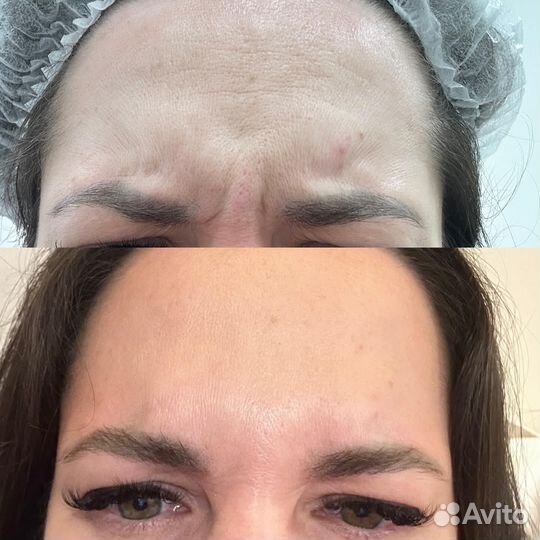 Все виды косметологических услуг. Мед образование