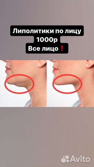 Аппаратная коррекция фигуры