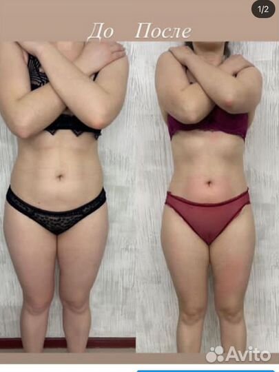 Антицеллюлитный массаж и обертывание