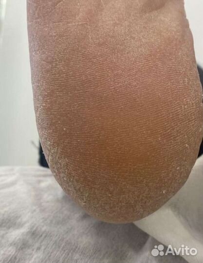 Смарт педикюр