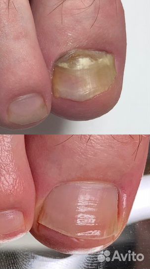 Подолог, проблемы стоп и ногтей, педикюр