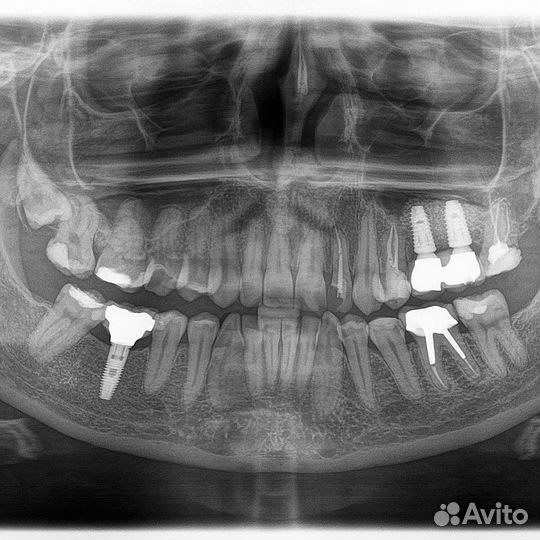Хирург имплантолог